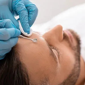 Acne & Blackheads