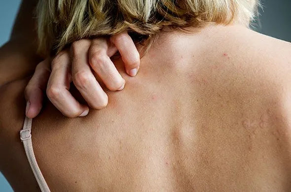 Commonly Affected Areas