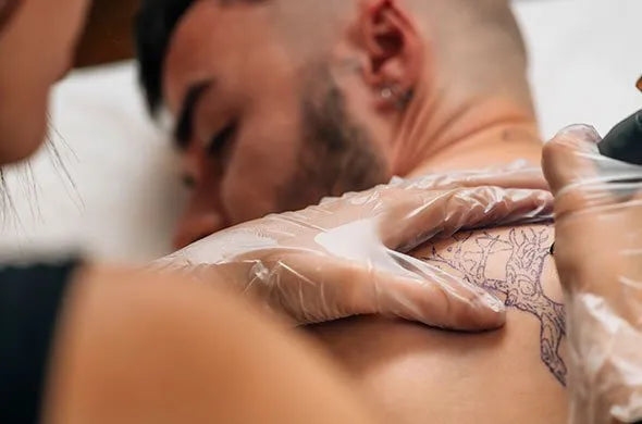 Why Choose Laser Tattoo Removal?